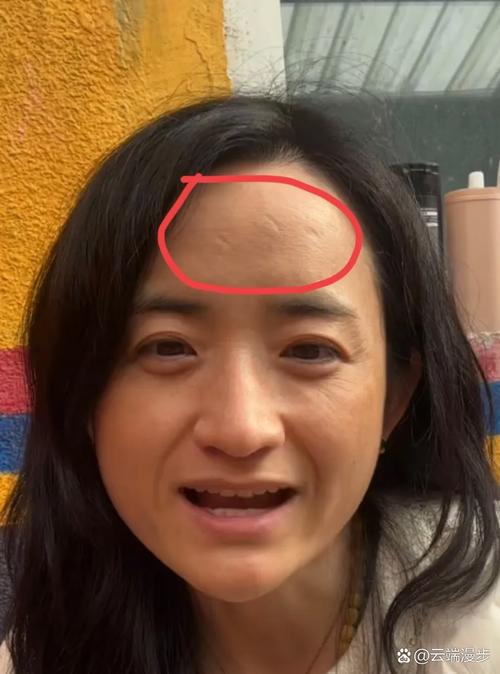 额头有疤的女明星盘点 这些印记反而成了独特标志