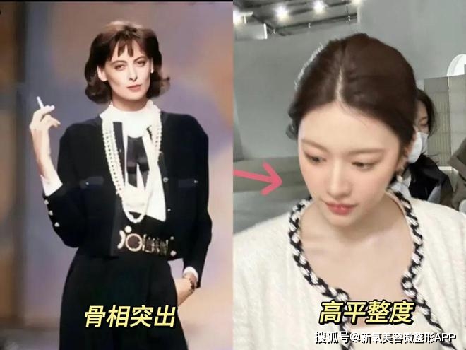 韩素希高颧骨审美_韩素希骨相美女_额头窄颧骨高的女明星